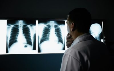 How X-Ray in Mandarin Supports Accurate Medical Diagnostics and Patient Care