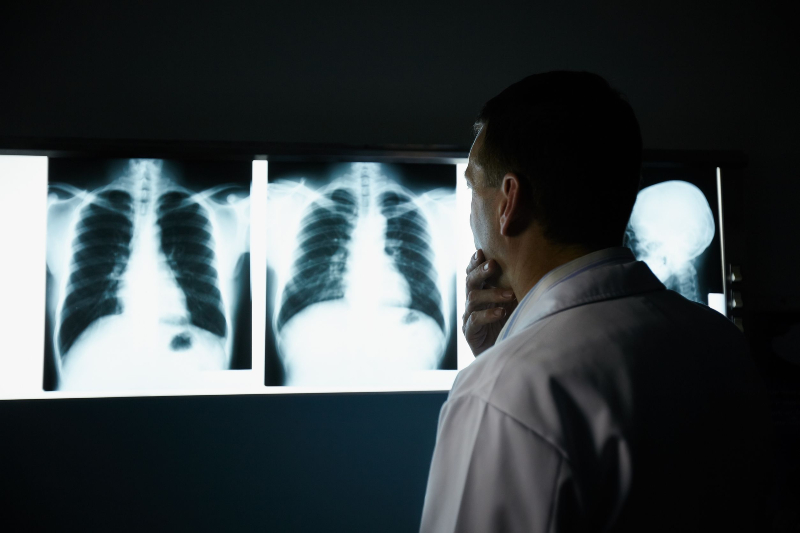 How X-Ray in Mandarin Supports Accurate Medical Diagnostics and Patient Care